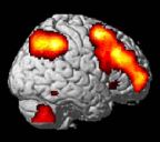 Dartmouth Brain Imaging Lab